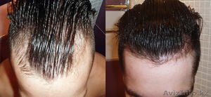 Kirkland 5% Minoxidil, 60мл. Для восстановления волос (Миноксидил) - Изображение #2, Объявление #1204336